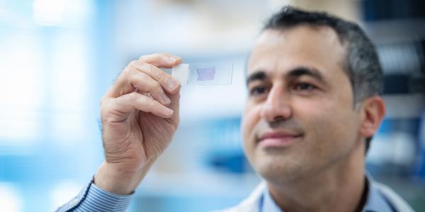 Dr. Ali Bashashati observes an endometrial cancer sample on a microscope slide.